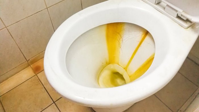 Will food coloring stain a toilet bowl